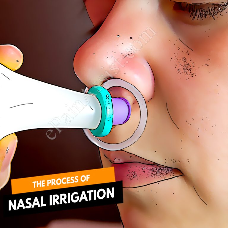 The Use of Nasal Irrigation for Sinusitis : Understanding its Mechanisms and Benefits