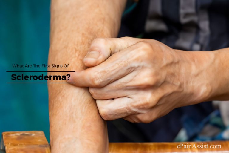 What Are The First Signs Of Scleroderma?