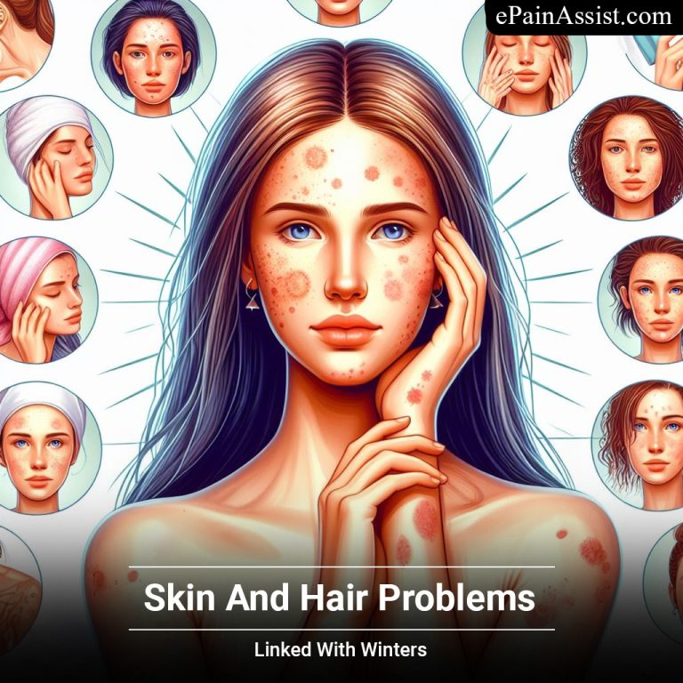 Skin And Hair Problems Linked With Winters