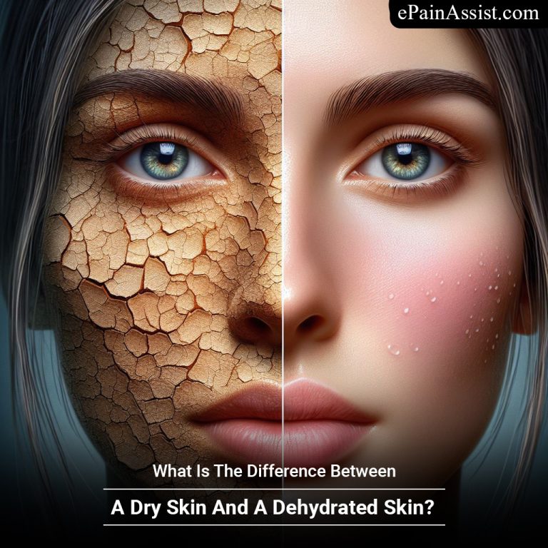 What Is The Difference Between A Dry Skin And A Dehydrated Skin?
