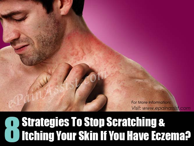 8 Strategies To Stop Scratching & Itching Your Skin If You Have Eczema?