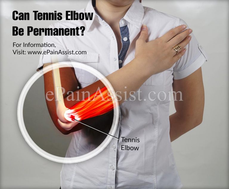 Can Tennis Elbow Be Permanent?