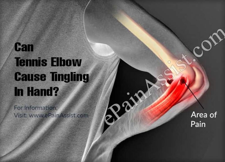 Can Tennis Elbow Cause Tingling In Hand?