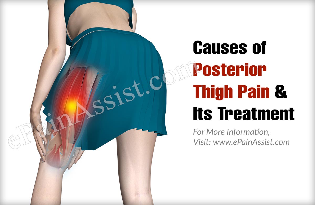 Causes of Posterior Thigh Pain & Its Treatment