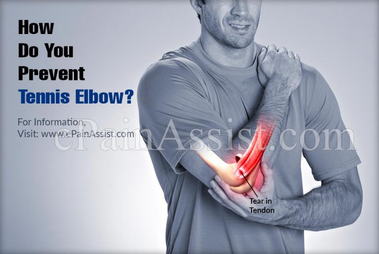 How Do You Prevent Tennis Elbow?