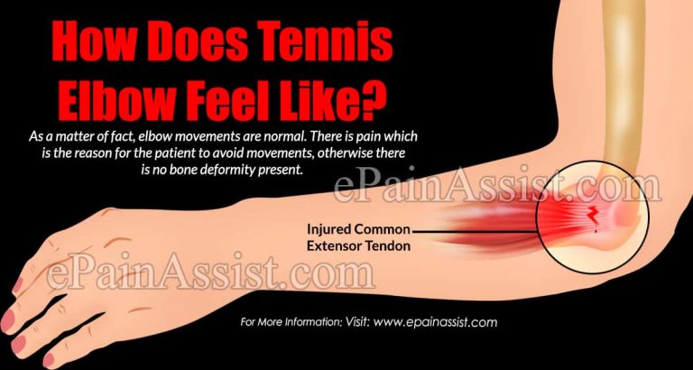 How Does Tennis Elbow Feel Like?