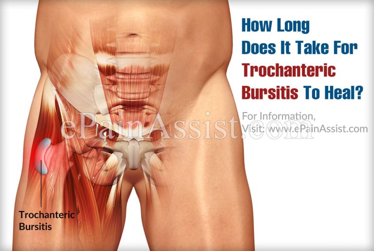 How Long Does It Take For Trochanteric Bursitis To Heal?