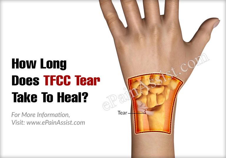 How Long Does TFCC Tear Take To Heal?