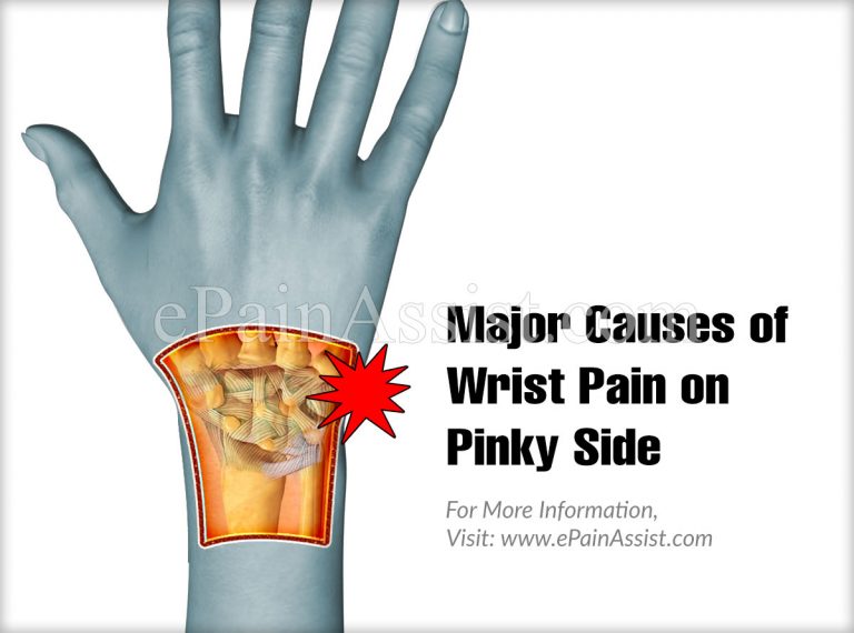 Major Causes of Wrist Pain on Pinky Side & Its Symptoms, Treatment