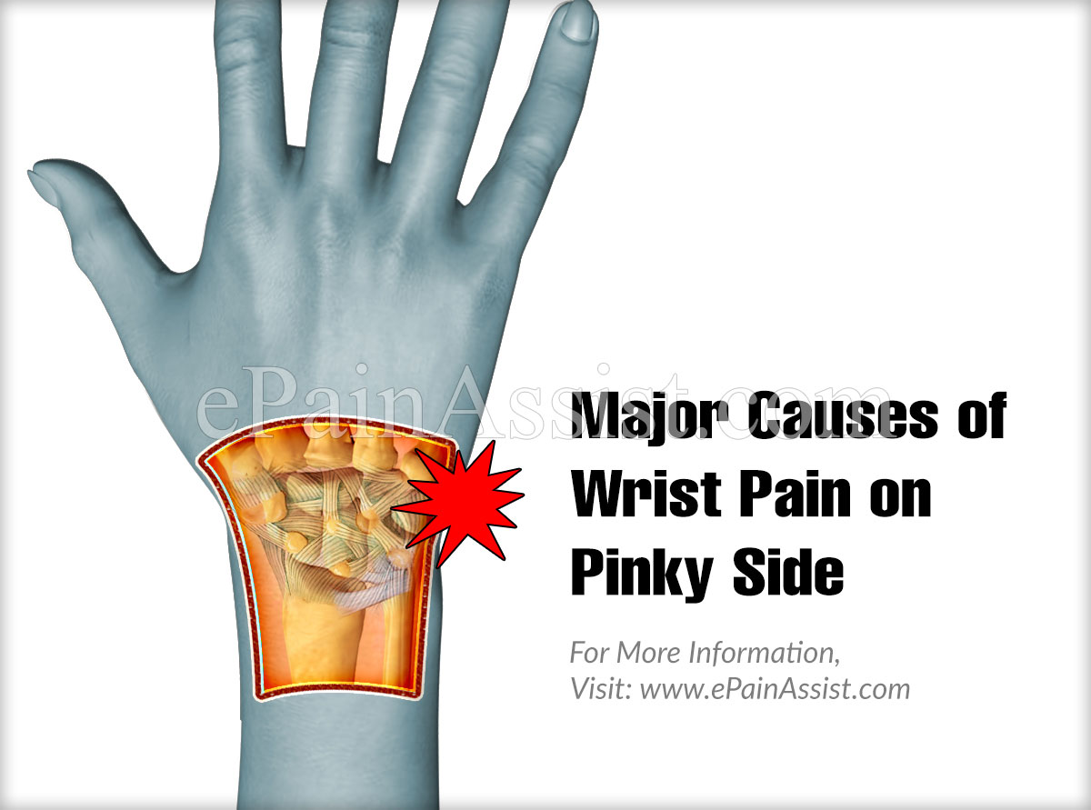 Major Causes of Wrist Pain on Pinky Side