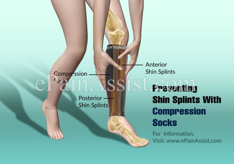 Preventing Shin Splints With Compression Socks