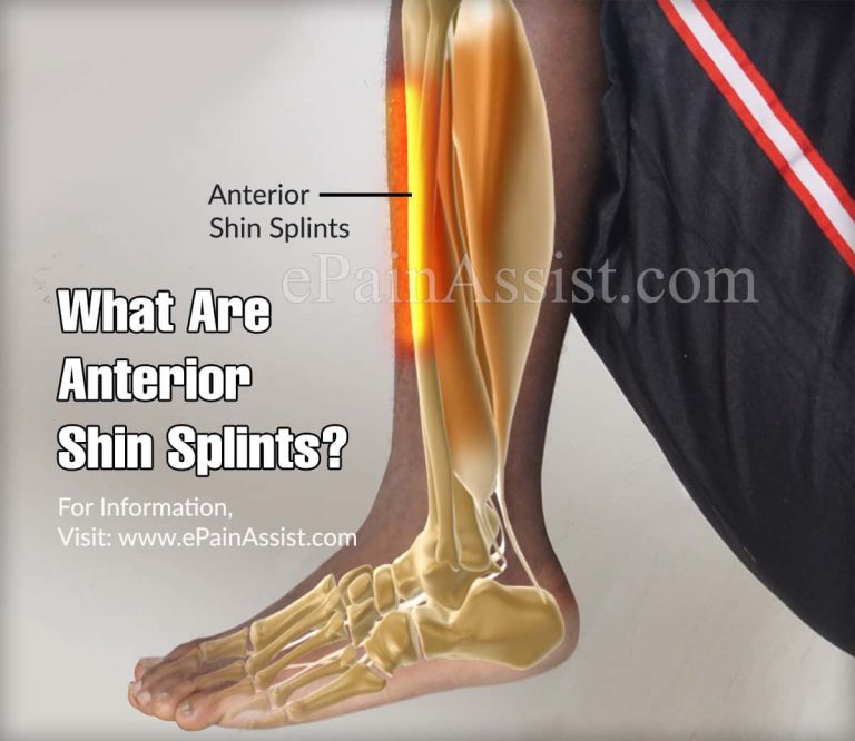 What Are Anterior Shin Splints?