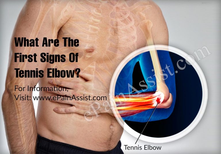 What Are The First Signs Of Tennis Elbow?