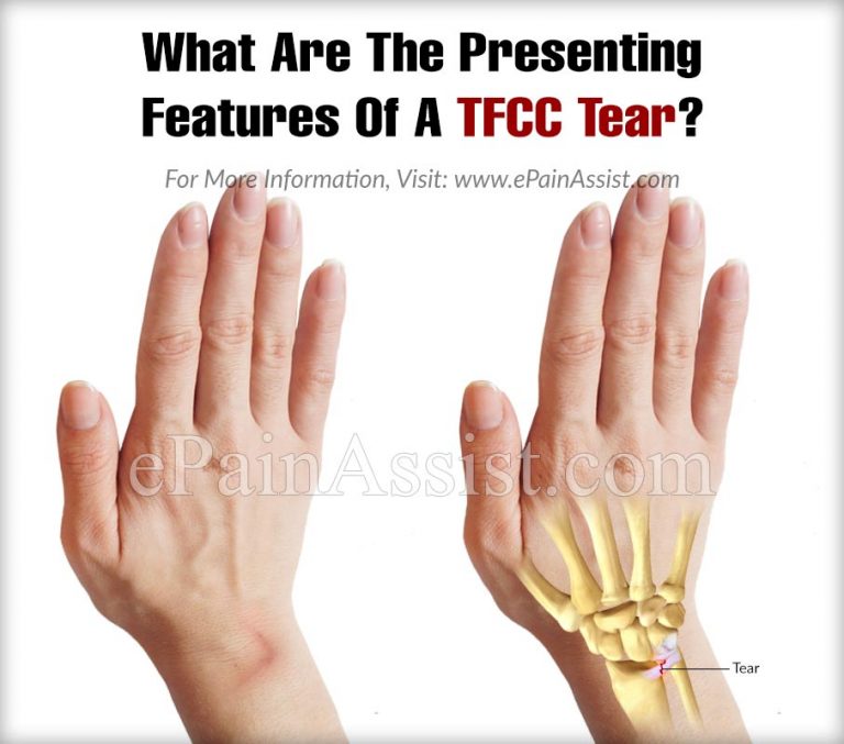 What Are The Presenting Features Of A TFCC Tear?