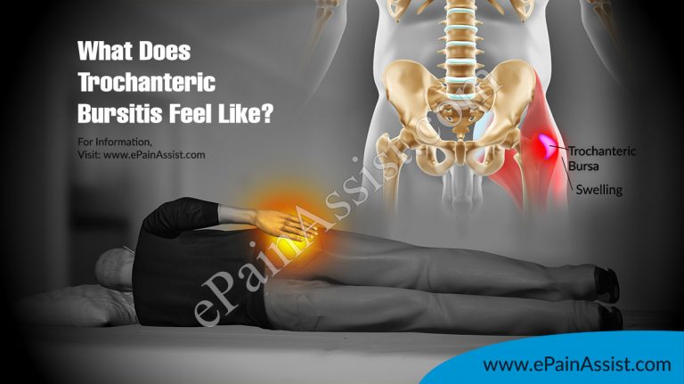 What Does Trochanteric Bursitis Feel Like?
