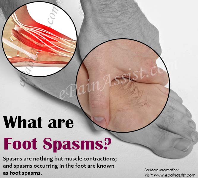 What are Foot Spasms?