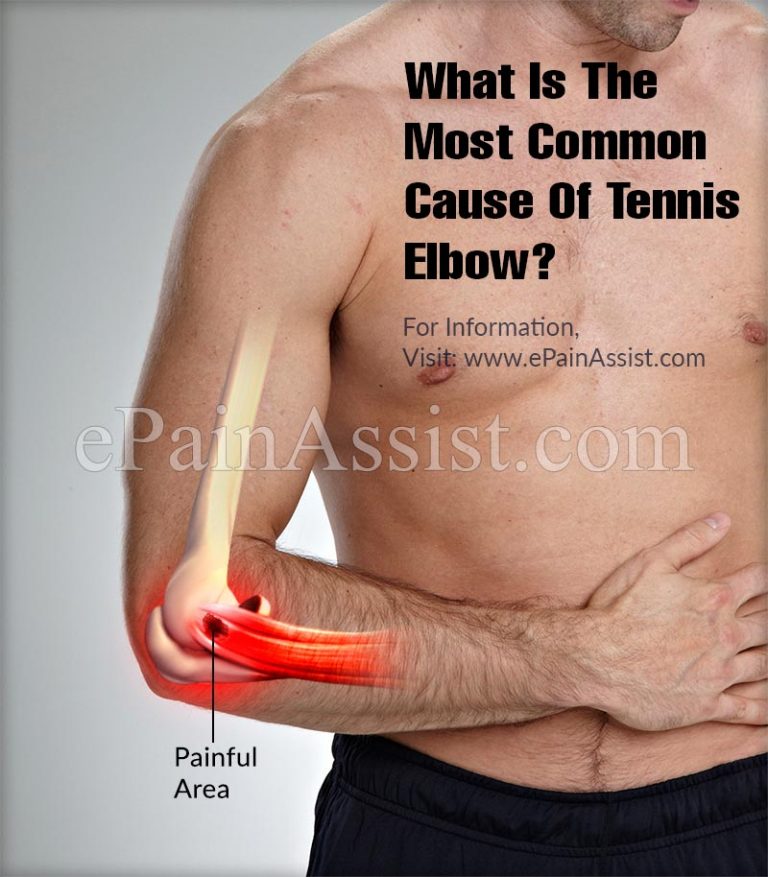 What Is The Most Common Cause Of Tennis Elbow?