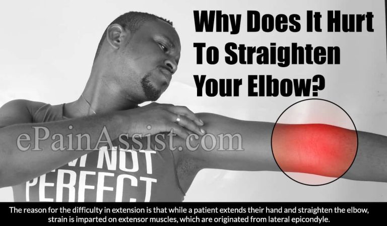 Why Does It Hurt To Straighten Your Elbow?