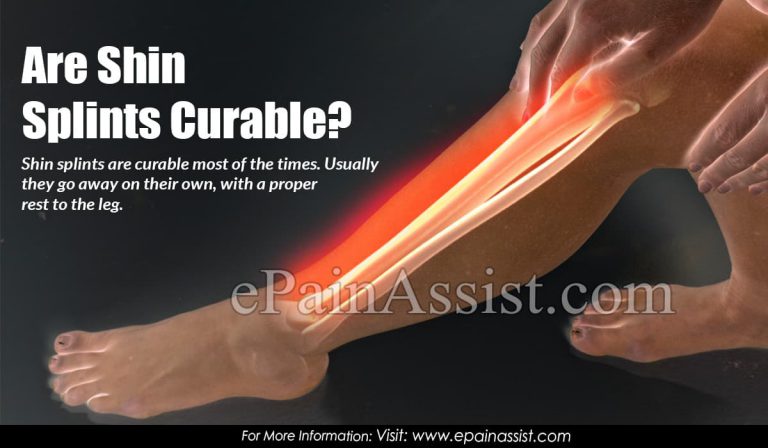 Are Shin Splints Curable?