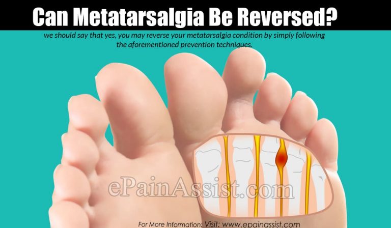 Can Metatarsalgia Be Reversed?