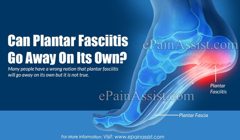 Can Plantar Fasciitis Go Away On Its Own?| How Do You Heal Plantar Fasciitis?