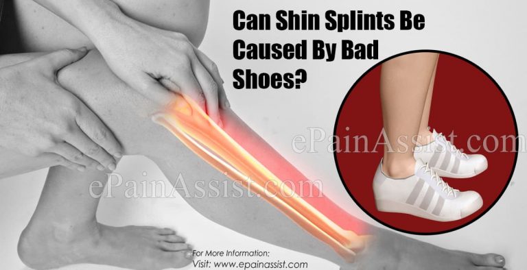 Can Shin Splints Be Caused By Bad Shoes?