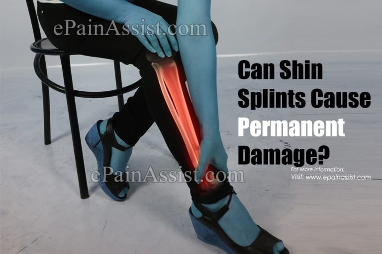 Can Shin Splints Cause Permanent Damage?