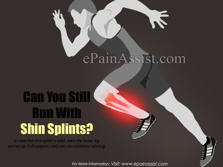 Can You Still Run With Shin Splints?