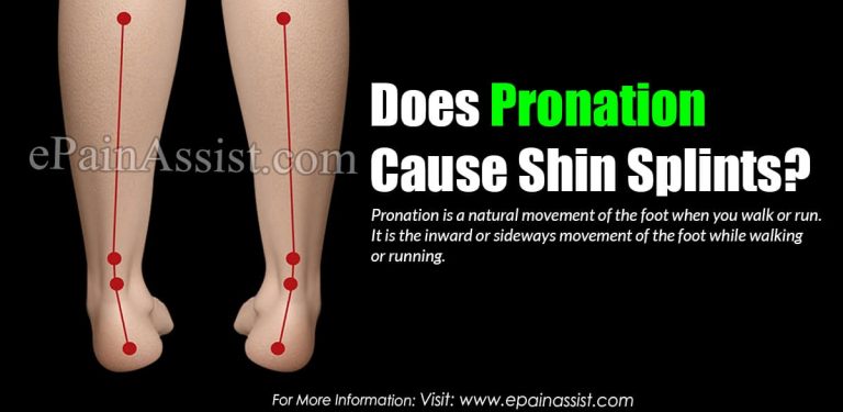 Does Pronation Cause Shin Splints?