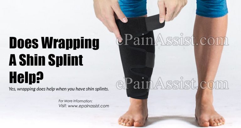 Does Wrapping A Shin Splint Help?