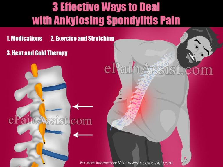 3 Effective Ways to Deal with Ankylosing Spondylitis Pain