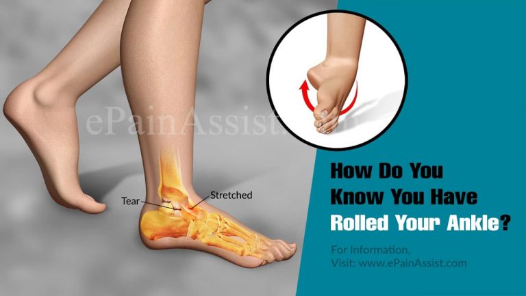 How Do You Know You Have Rolled Your Ankle & How Long Does A Rolled Ankle Take To Heal?