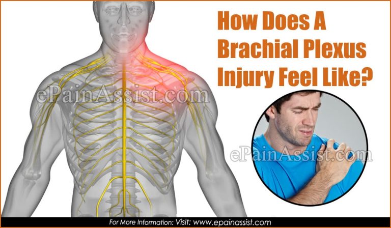 How Does A Brachial Plexus Injury Feel Like?