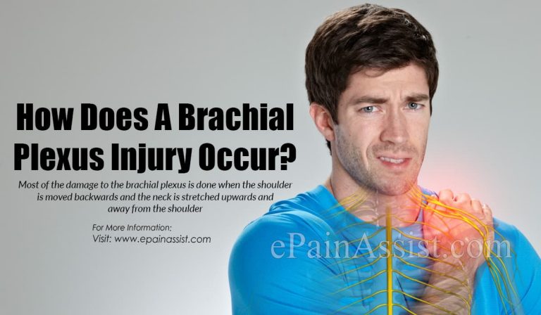How Does A Brachial Plexus Injury Occur?