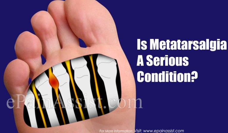 Is Metatarsalgia A Serious Condition?