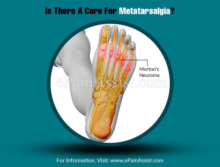 Is There A Cure For Metatarsalgia?
