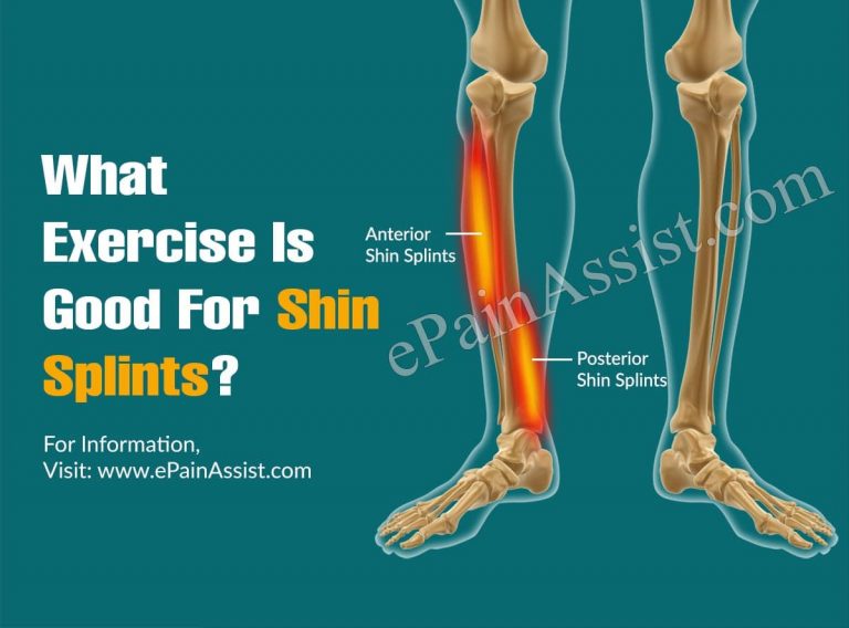 What Exercise Is Good For Shin Splints?