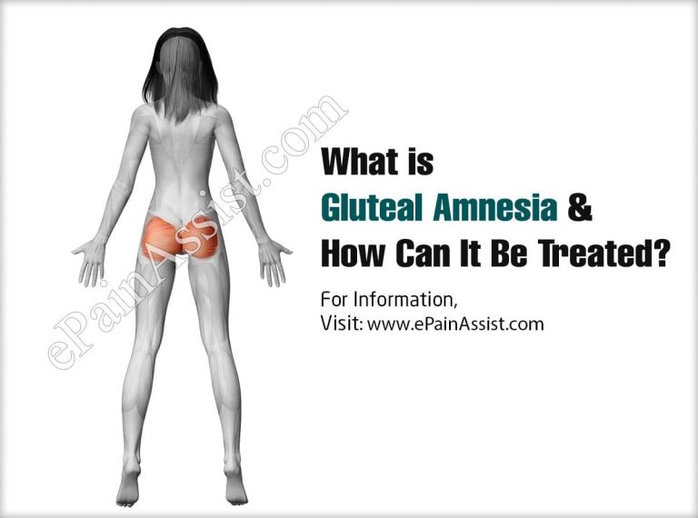 What is Gluteal Amnesia & How Can It Be Treated?