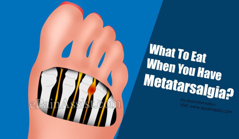 What To Eat When You Have Metatarsalgia?
