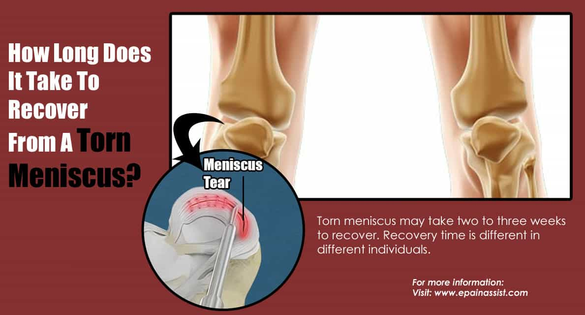 How Long Does It Take To Recover From A Torn Meniscus?