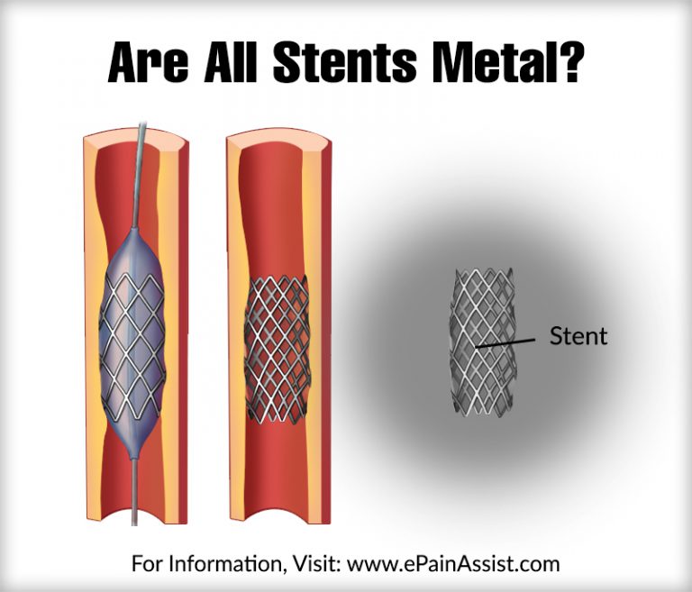 Are All Stents Metal?