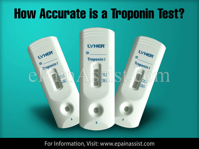 How Accurate is a Troponin Test?