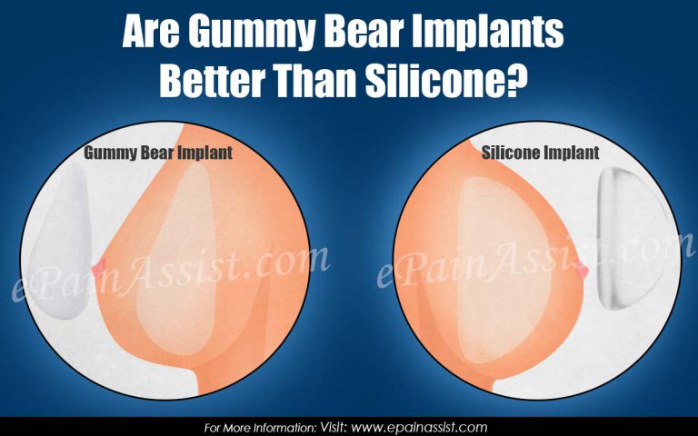 Are Gummy Bear Implants Better Than Silicone?