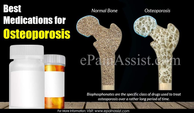 Best Medications for Osteoporosis