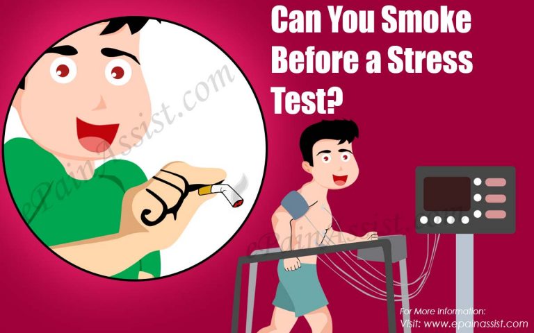Can You Smoke Before a Stress Test?