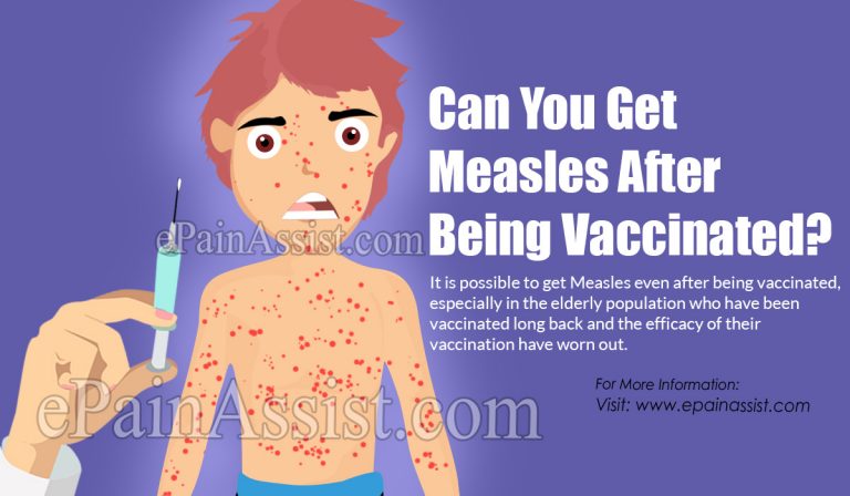 Can You Get Measles After Being Vaccinated?