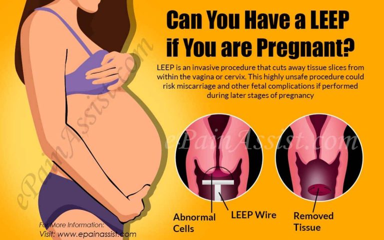 Can You Have a LEEP if You are Pregnant?