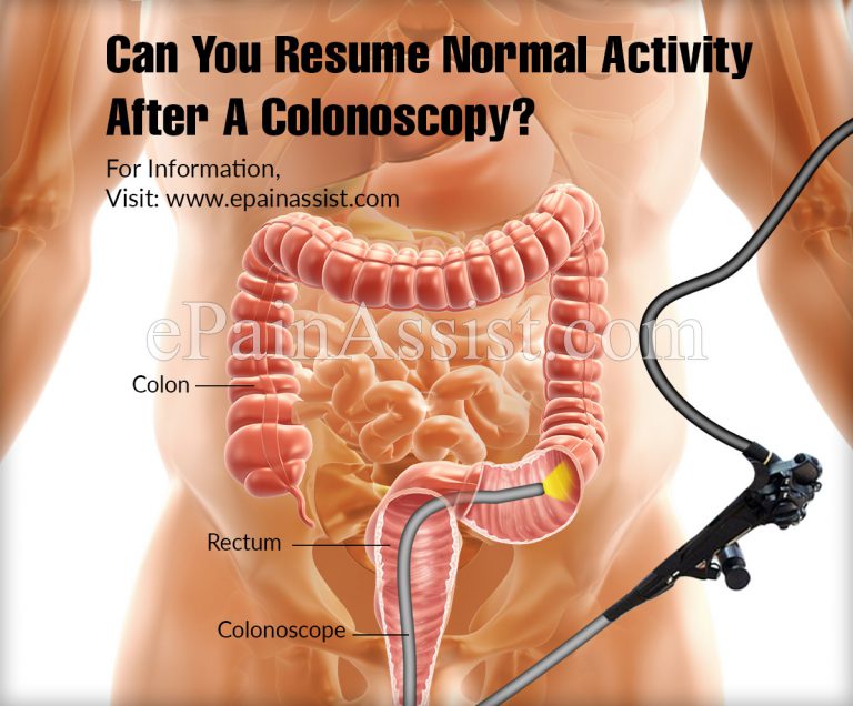 Can You Resume Normal Activity After A Colonoscopy?