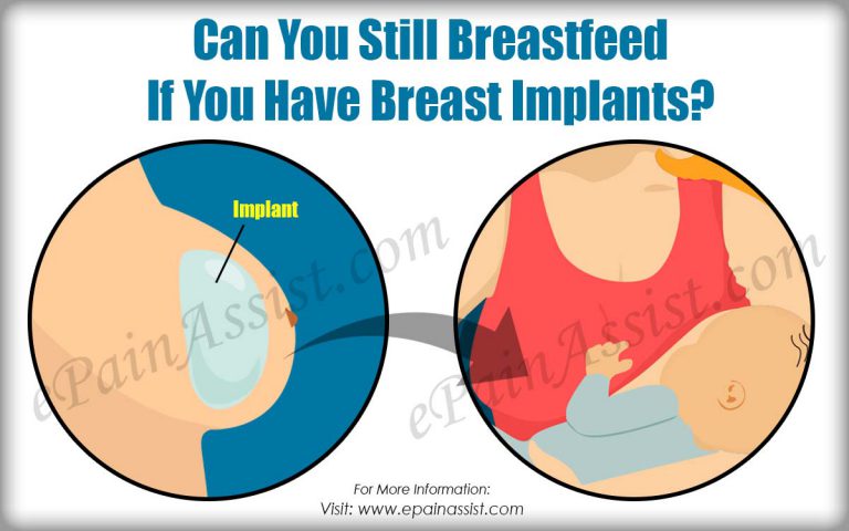 Breastfeeding with Breast Implants: What You Need to Know