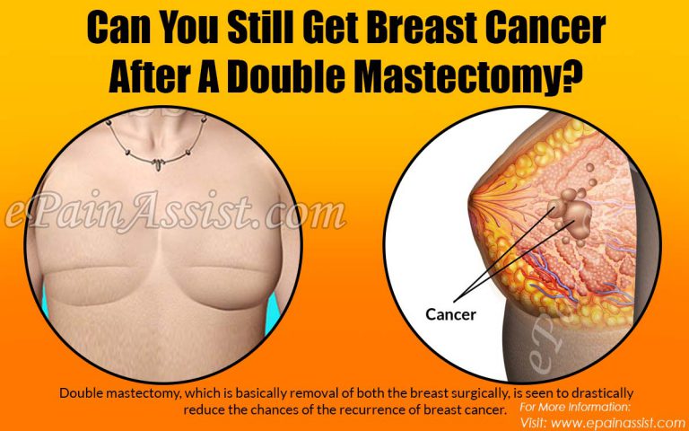 Can You Still Get Breast Cancer After A Double Mastectomy?
